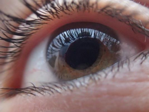 Miért romlik a szemem és mikortól javítható a látásom lézerrel?